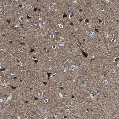 Immunohistochemistry-Paraffin: AGAP3 Antibody [NBP1-85685]