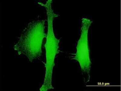Immunocytochemistry/ Immunofluorescence: AGBL5 Antibody [H00060509-B01P]