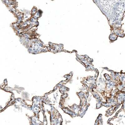 Immunohistochemistry-Paraffin: AGER Antibody (CL10587) [NBP3-07982]