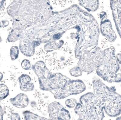 Immunohistochemistry-Paraffin: AGER Antibody (CL10587) [NBP3-07982]