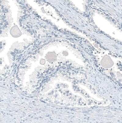 Immunohistochemistry-Paraffin: AGER Antibody (CL10587) [NBP3-07982]
