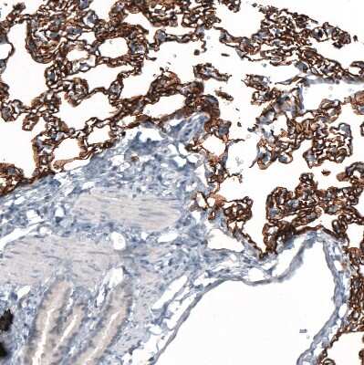 Immunohistochemistry-Paraffin: AGER Antibody (CL10587) [NBP3-07982]