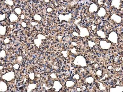 Immunohistochemistry-Paraffin: AGER Antibody [NBP3-13484]