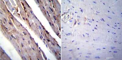 Immunohistochemistry-Paraffin: AGER Antibody [NBP3-13484]