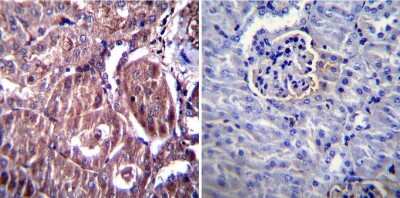 Immunohistochemistry-Paraffin: AGER Antibody [NBP3-13484]