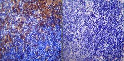 Immunohistochemistry-Paraffin: AGER Antibody [NBP3-13484]