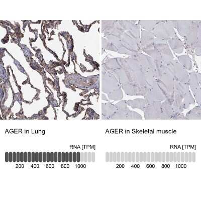 Immunohistochemistry-Paraffin: AGER Antibody [NBP3-16981]