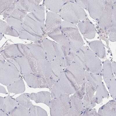 Immunohistochemistry-Paraffin: AGER Antibody [NBP3-16981]