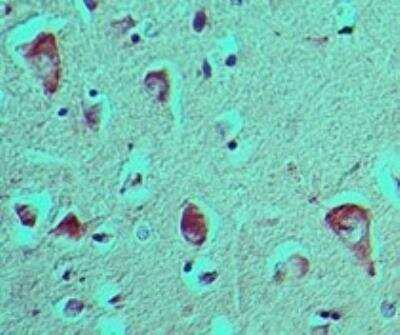Immunohistochemistry-Paraffin: AGER Antibody [NBP3-18000]