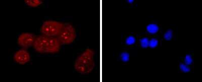 Immunocytochemistry/ Immunofluorescence: AGER Antibody (JF0975) [NBP2-67095]