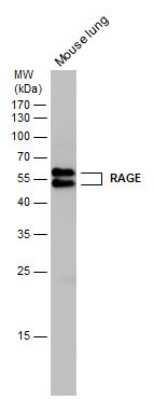 Western Blot: AGER Antibody [NBP3-13484]