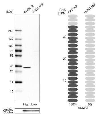 Western Blot: AGMAT Antibody [NBP1-82080]
