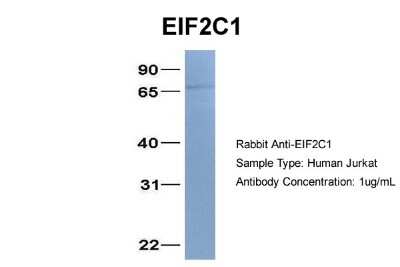 Western Blot: AGO1/EIF2C1 Antibody [NBP1-56530]