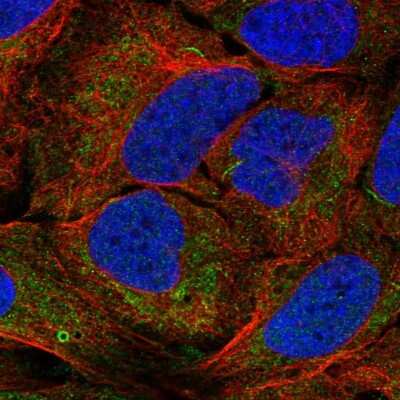 Immunocytochemistry/ Immunofluorescence: AGPAT1 Antibody [NBP2-55555]