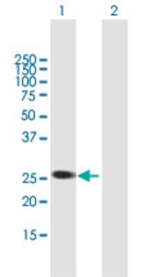 Western Blot: AGPAT1 Antibody [H00010554-B02P]