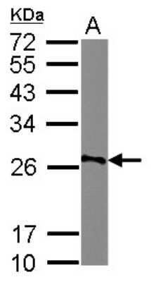 Western Blot: AGPAT1 Antibody [NBP2-14867]