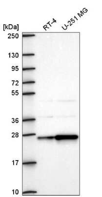 Western Blot: AGPAT1 Antibody [NBP2-57898]