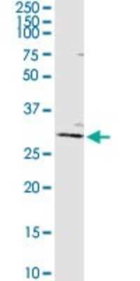 Western Blot: AGPAT2 Antibody [H00010555-D01P]