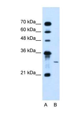 Western Blot: AGPAT2 Antibody [NBP1-59734]