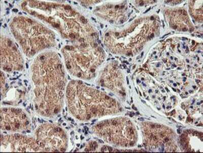 Immunohistochemistry-Paraffin: AGPAT5 Antibody (OTI2C4) [NBP2-01664]