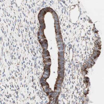 Immunohistochemistry-Paraffin: AGPAT5 Antibody [NBP1-83768]