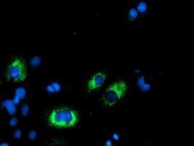Immunocytochemistry/ Immunofluorescence: AGPAT5 Antibody (OTI2C4) - Azide and BSA Free [NBP2-72002]