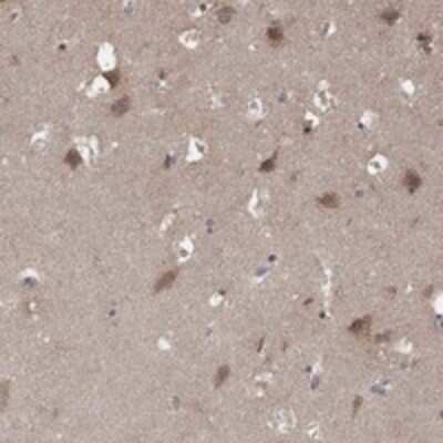 Immunohistochemistry-Paraffin: AGPAT7 Antibody [NBP3-17567]