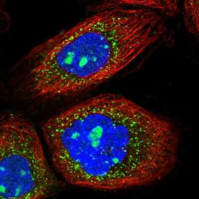 Immunocytochemistry/ Immunofluorescence: AGPS Antibody [NBP1-89241]