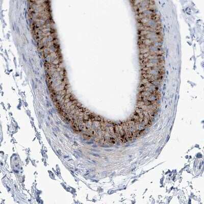 Immunohistochemistry-Paraffin: AGPS Antibody [NBP1-89242]