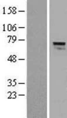 Western Blot: AGPS Overexpression Lysate [NBL1-07389]