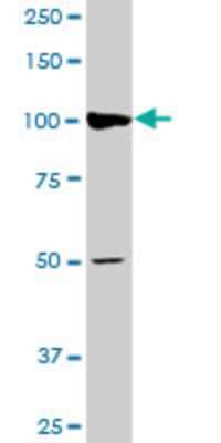 Western Blot: AGTPBP1 Antibody (2B9) [H00023287-M03]