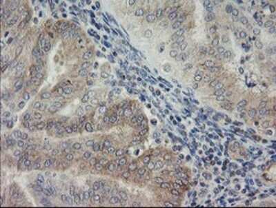 Immunohistochemistry: AGTPBP1 Antibody (OTI9A3) [NBP2-46502]