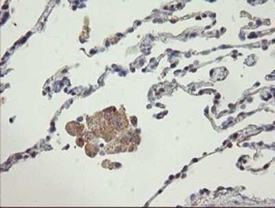 Immunohistochemistry: AGTPBP1 Antibody (OTI9A3) [NBP2-46502]
