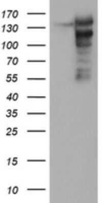 Western Blot: AGTPBP1 Antibody (OTI9A3) [NBP2-46502]