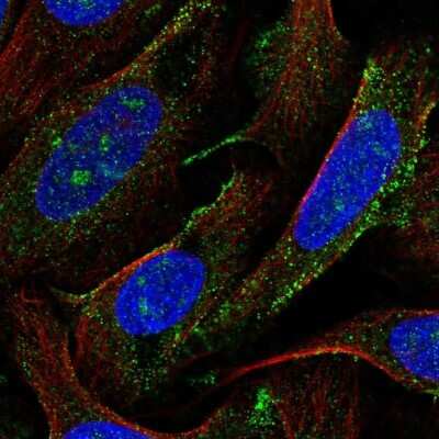 Immunocytochemistry/ Immunofluorescence: AGTPBP1 Antibody [NBP2-31662]