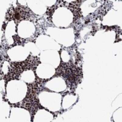 Immunohistochemistry-Paraffin: AGTPBP1 Antibody [NBP3-17647]