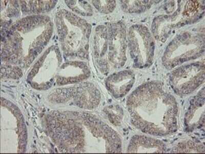 Immunohistochemistry: AGTPBP1 Antibody (OTI9A3) - Azide and BSA Free [NBP2-71734]