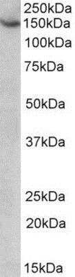 Western Blot: AGTPBP1 Antibody [NBP1-52106]