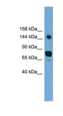 Western Blot: AGTPBP1 Antibody [NBP1-79579]