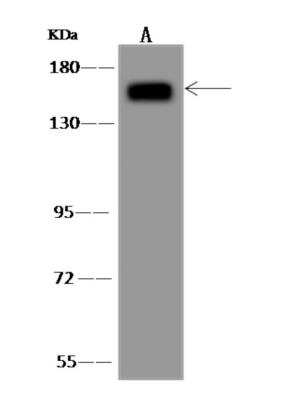 Western Blot: AGTPBP1 Antibody [NBP3-06124]