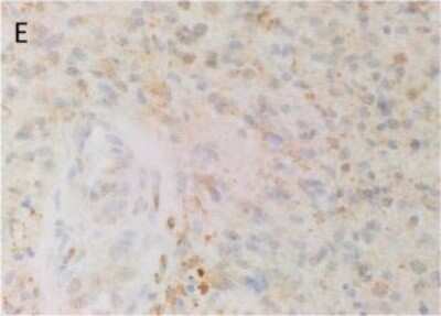 Immunohistochemistry-Paraffin: AGTR-2 Antibody - BSA Free [NBP1-77368]