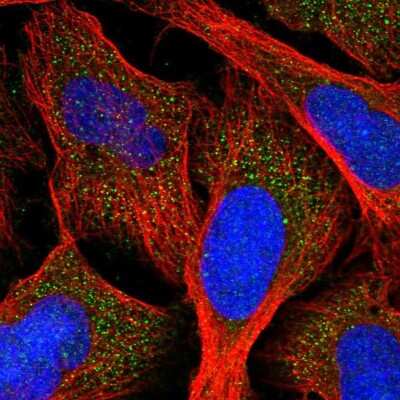 Immunocytochemistry/ Immunofluorescence: AGXT Antibody [NBP2-34198]