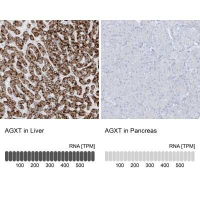 Immunohistochemistry-Paraffin: AGXT Antibody [NBP1-89200]