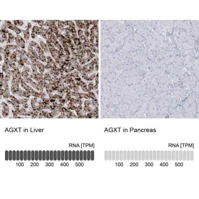Immunohistochemistry-Paraffin: AGXT Antibody [NBP2-34198]