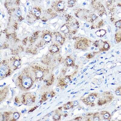 Immunohistochemistry-Paraffin: AGXT Antibody - BSA Free [NBP2-92542]