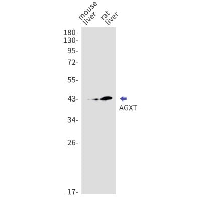 Western Blot: AGXT Antibody (S02-7A4) [NBP3-19562]
