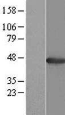 Western Blot: AGXT Overexpression Lysate [NBP2-09062]