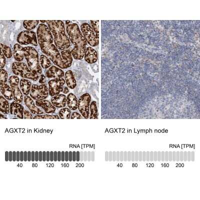 Immunohistochemistry-Paraffin: AGXT2 Antibody [NBP1-89199]