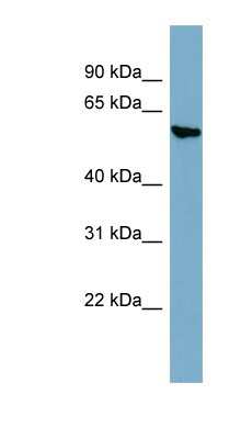 Western Blot: AGXT2 Antibody [NBP1-79303]