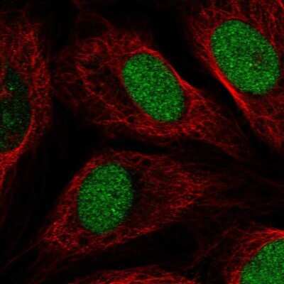 Immunocytochemistry/ Immunofluorescence: AGXT2L1 Antibody [NBP2-57397]